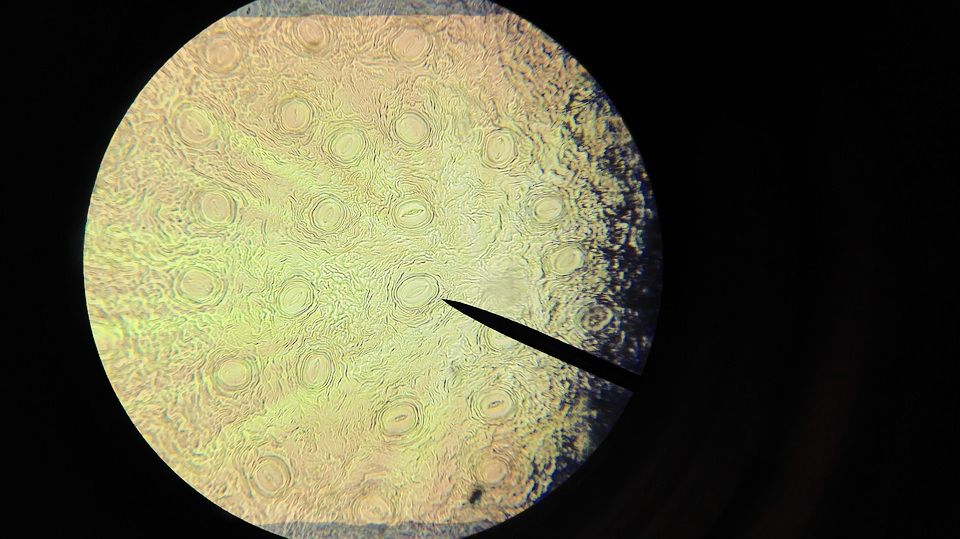 bunka skumavka microscope-1471068_960_720