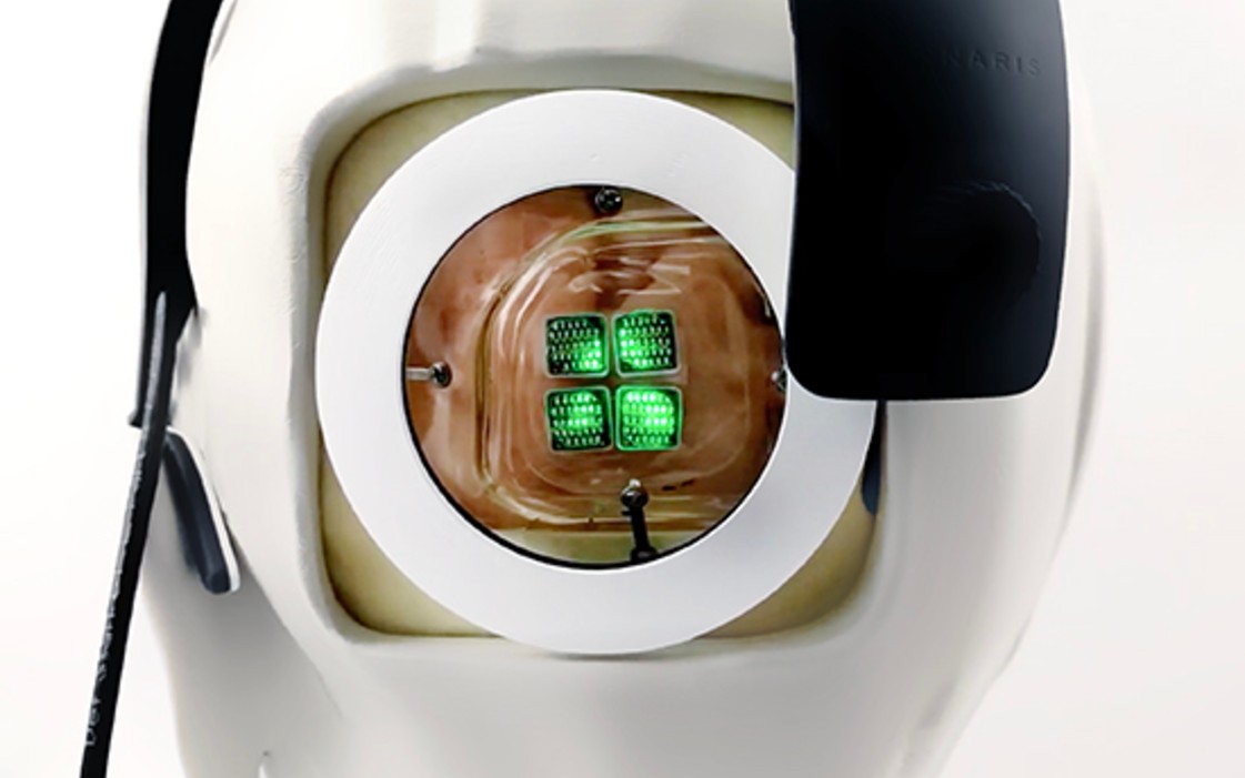 implantant ktory vrati zrak
