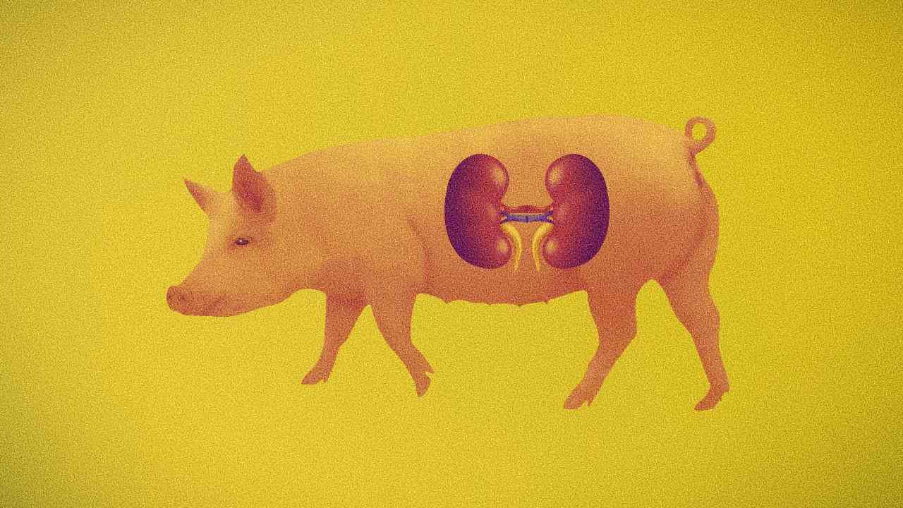 Xenotransplantácia transplantacia obliciek