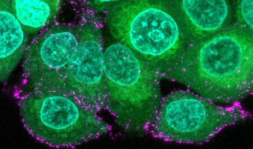 virus SARS-CoV-2
