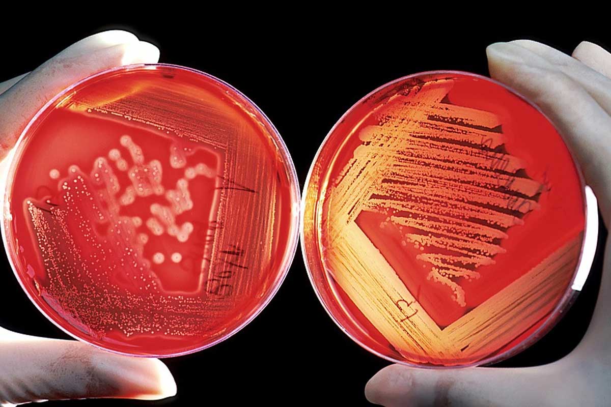 Vedci z University of British Columbia vytvorili nový druh biopolyméru