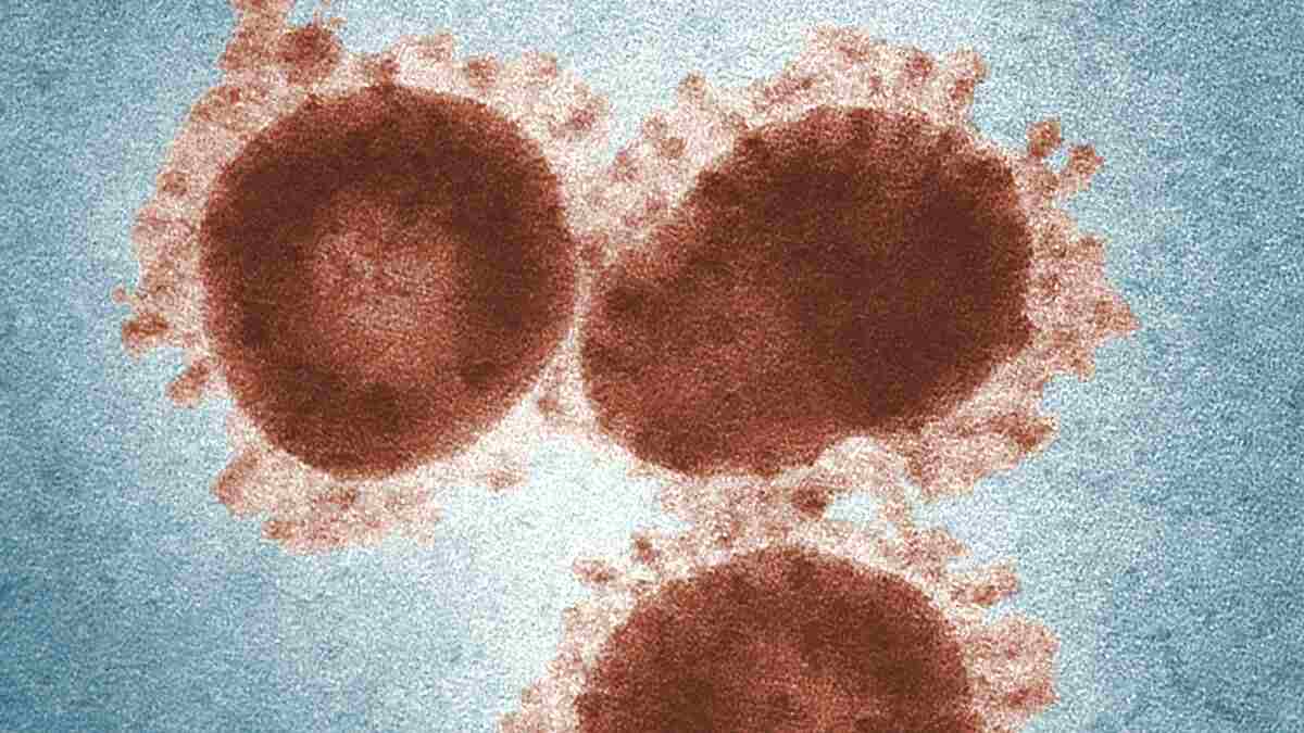virus_choroba