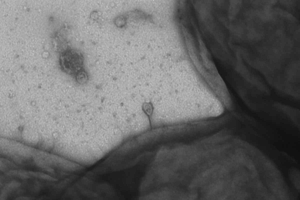 Vedci našli zbraň proti baktériám, odolným voči antibiotikám