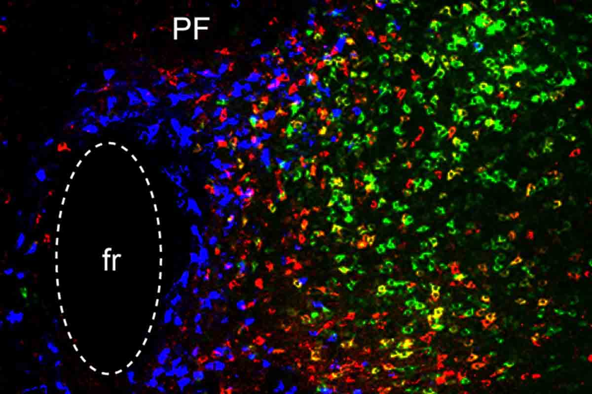 Tri neurónové obvody môžu byť kľúčom k liečbe Parkinsonovej choroby