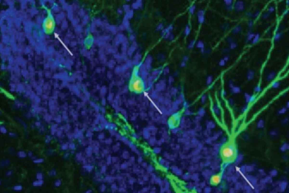 Podporenie neurogenézy dokáže zlepšiť pamäť myší, postihnutých alzheimerovou chorobou