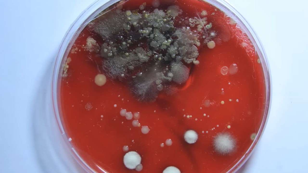 rast bakterii