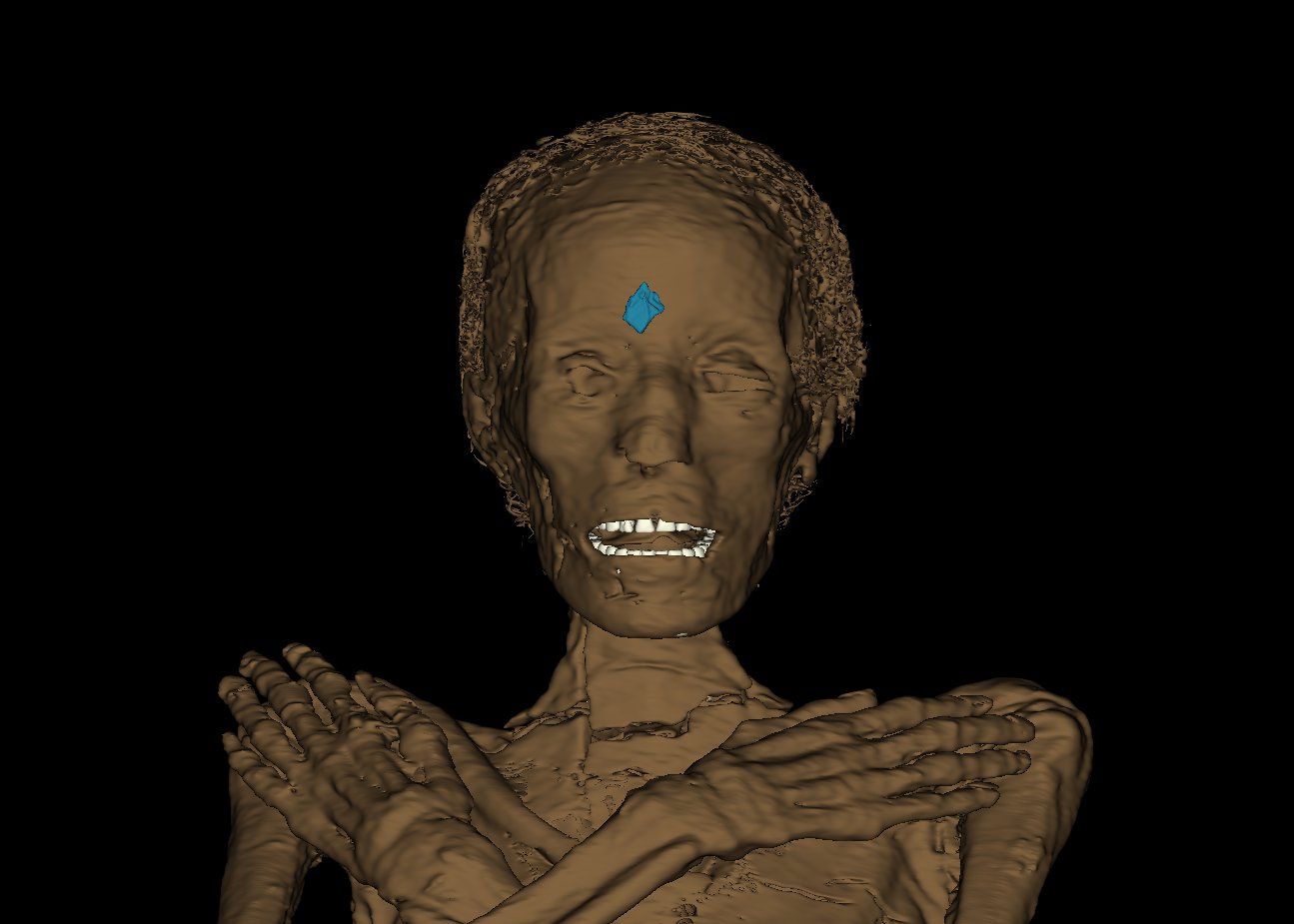 tehotna mumia