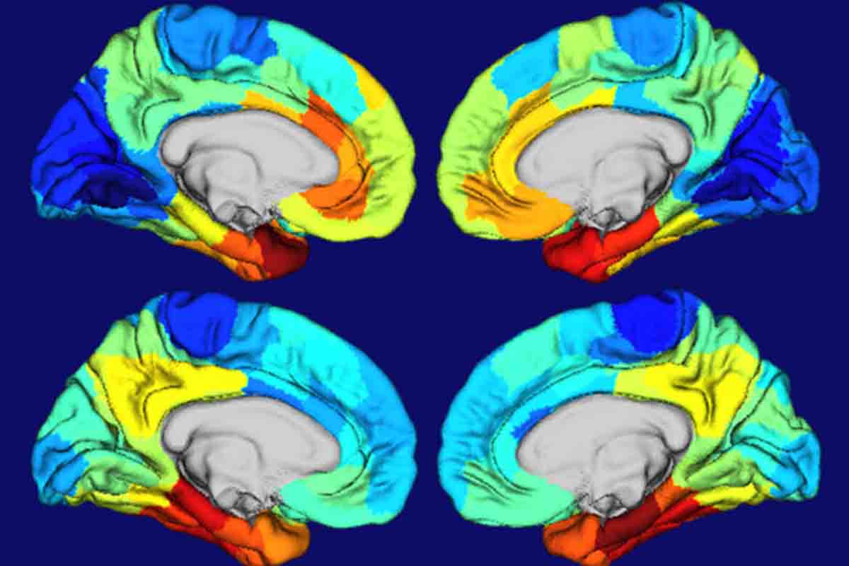 Alzheimerova choroba postihuje určité regióny mozgu a autori štúdie prichádzajú na to, prečo je to tak