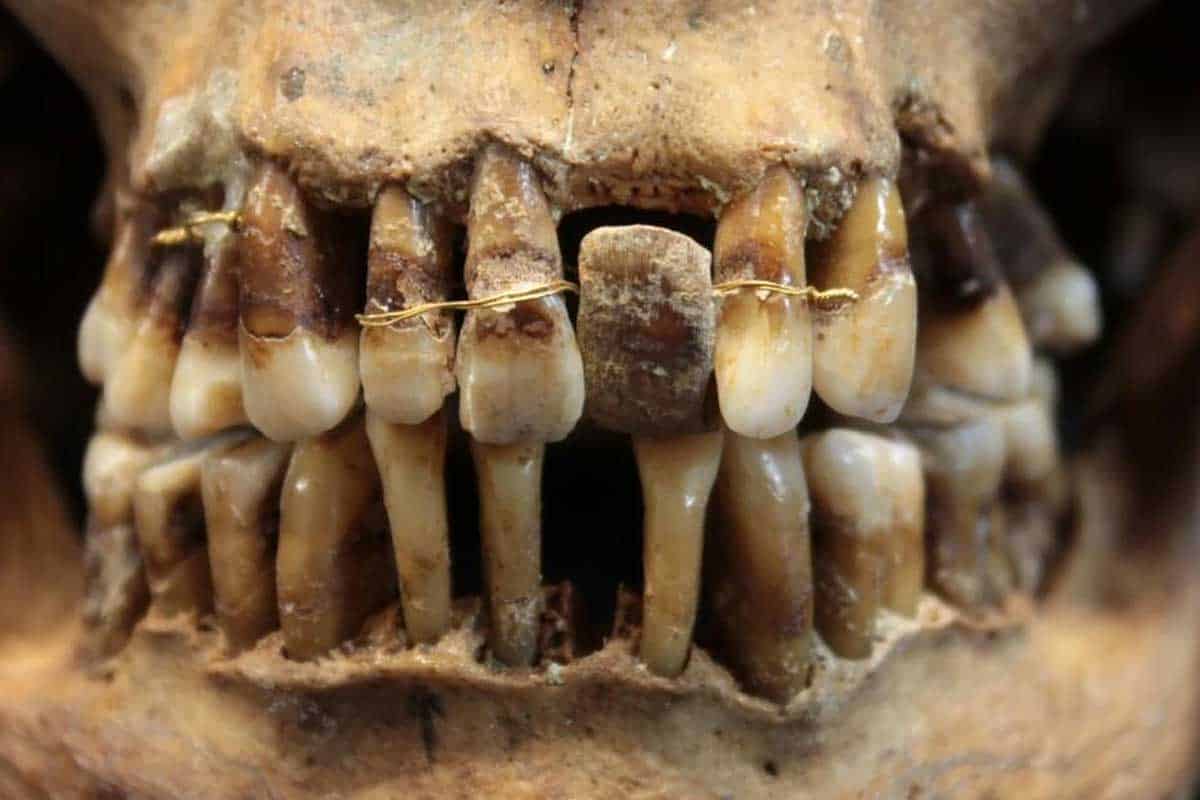 Zubárstvo 17. storočia ukazuje dôležitosť dokonalého vzhľadu