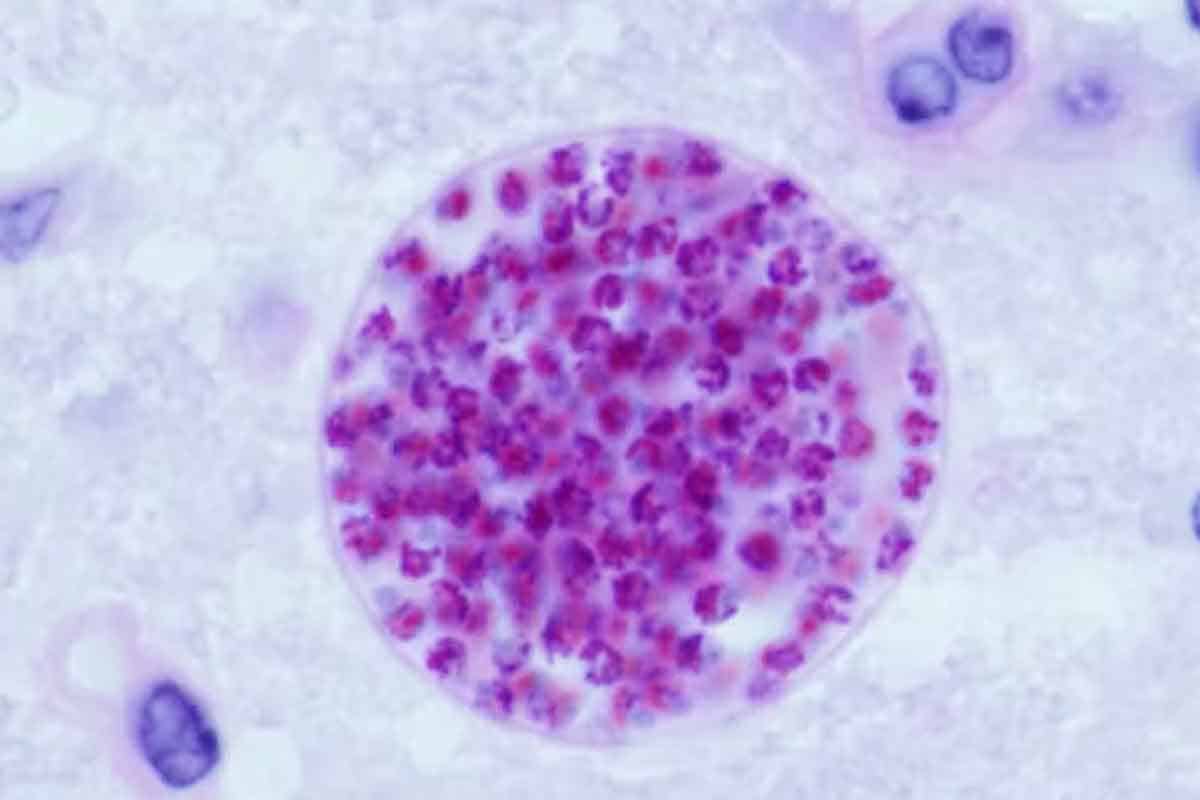 Toxoplazmóza má potenciál ovplyvniť aj správanie človeka