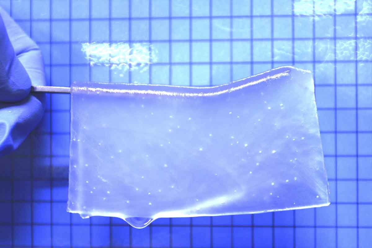 Výskumníci vyvinuli špeciálny hydrogél, ktorý umožňuje neurónovým bunkám rásť