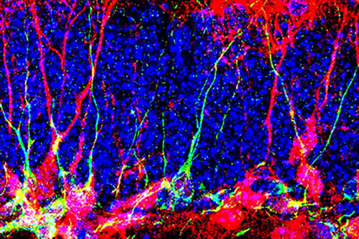 Vytvorenie nových neurónov môže pomôcť liečbe rôznych neurodegeneratívnych ochorení