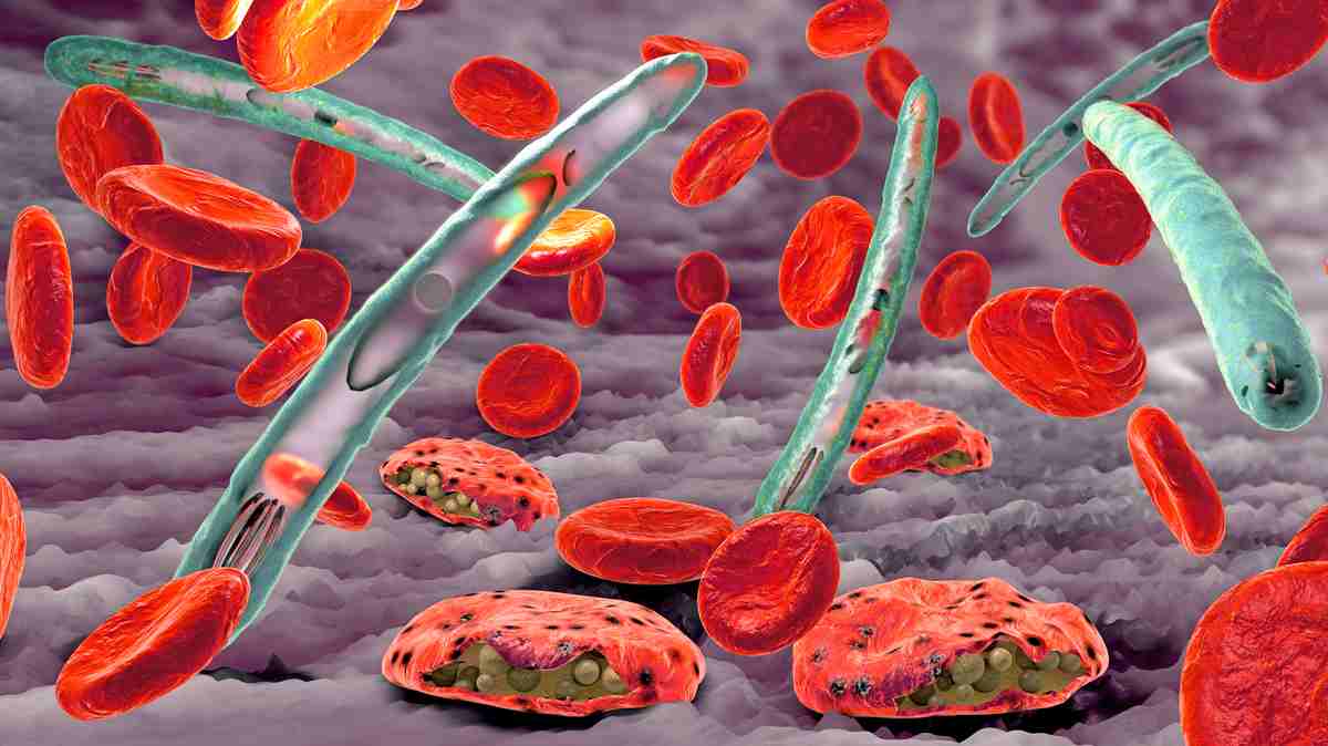 Malaria