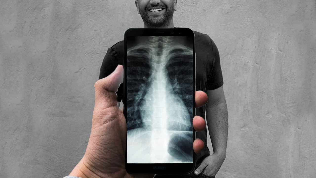 Vedci vytvorili čip, ktorý dovolí smartfónu vidieť cez steny