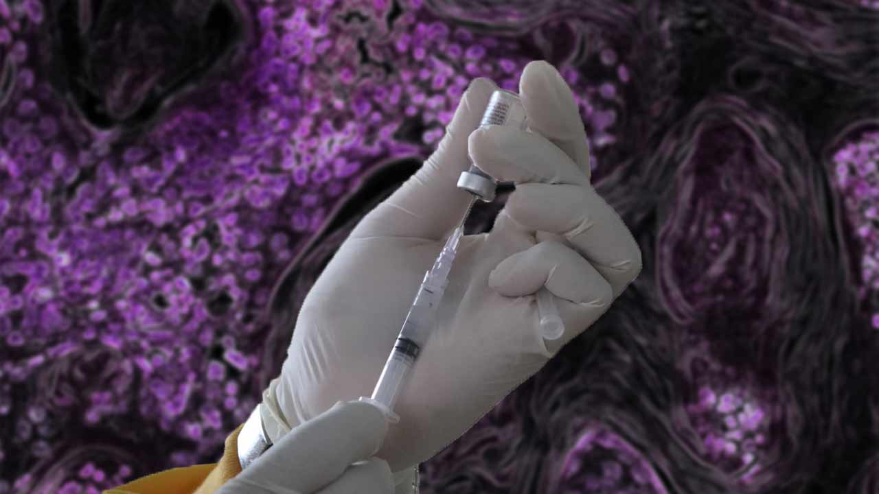 Lekári podali prvé experimentálne očkovanie proti rakovine