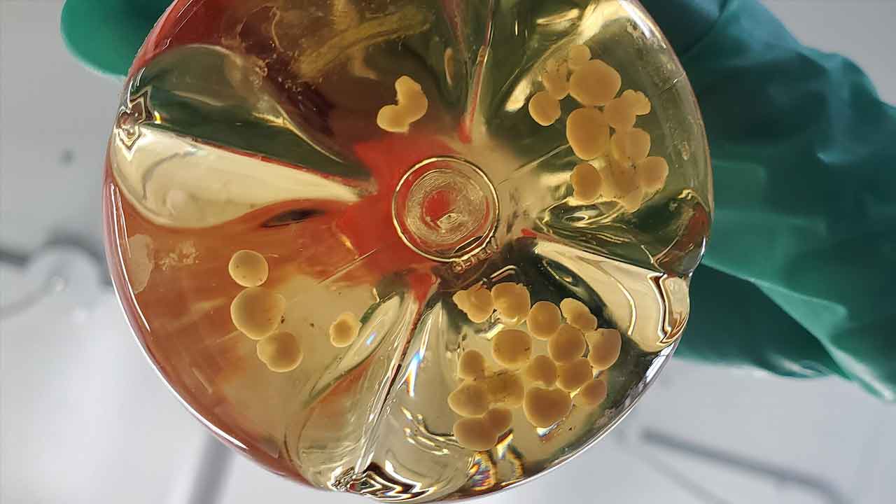 Výskumníci vytvorili prvý organoid celého mozgu