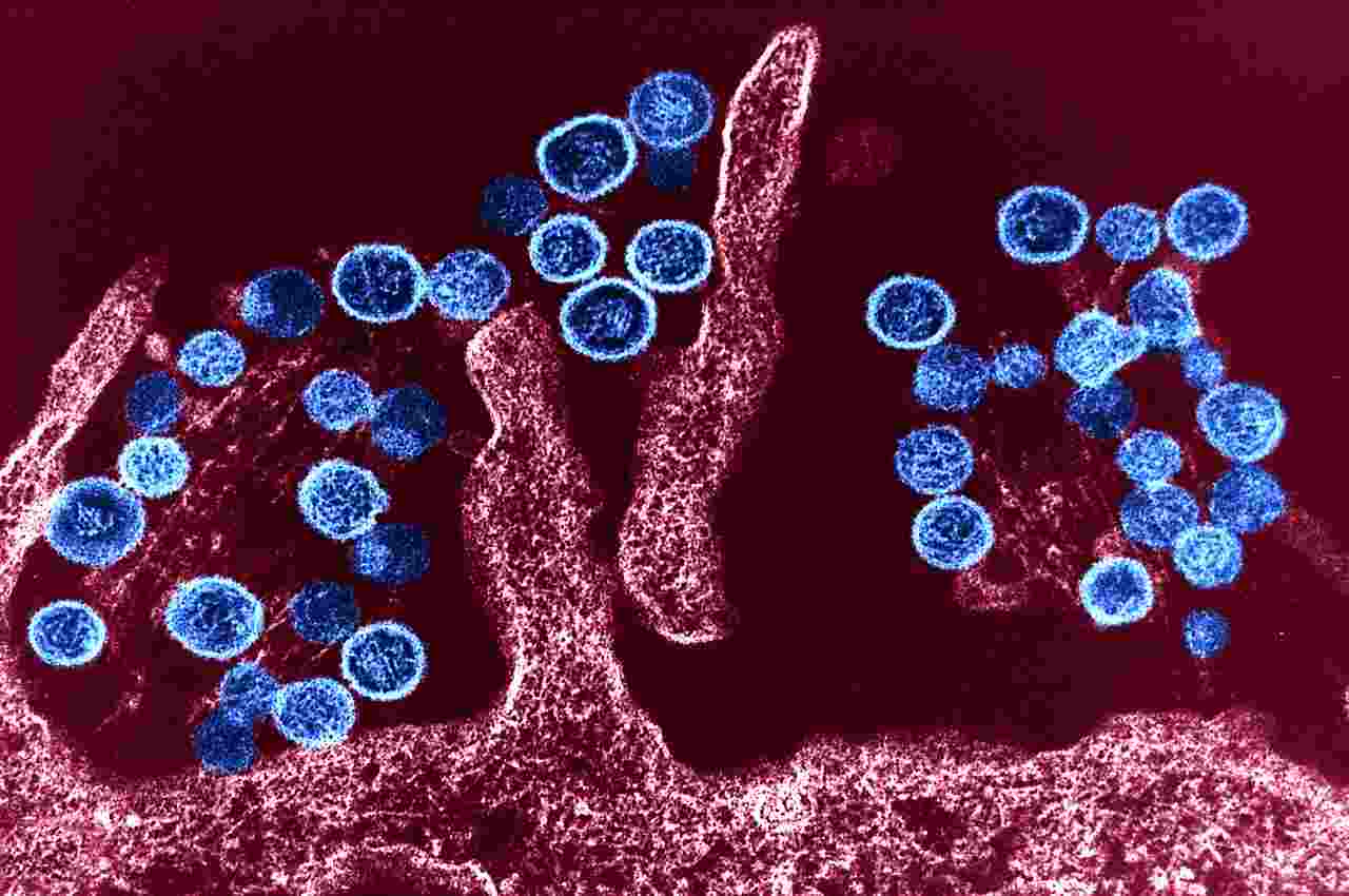 hantavirus