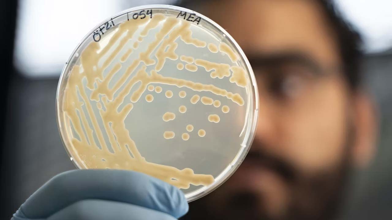 Výskumníci vykonali doteraz najdetailnejšiu genetickú analýzu Otziho, ľadového muža