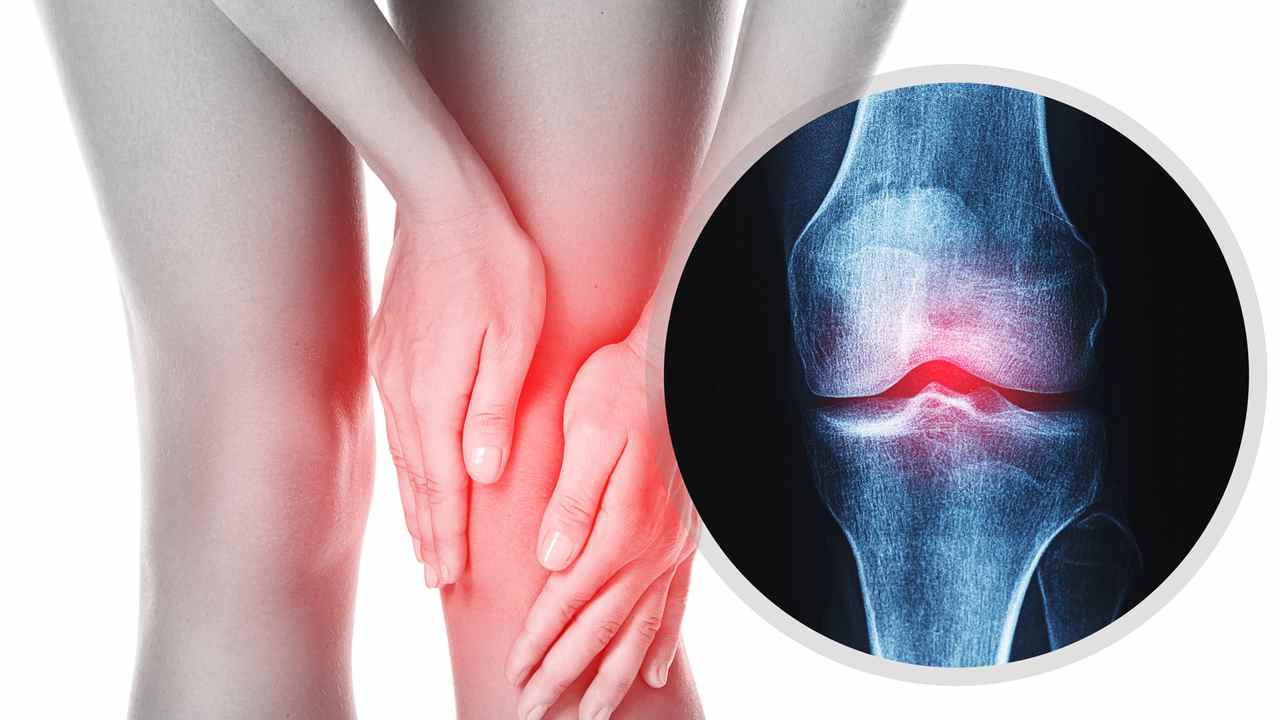 Osteoartroza klby